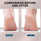 GoodzVill™ Heels Grinding Tool